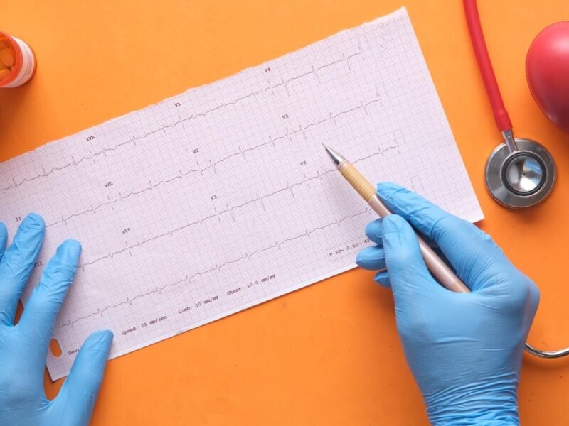 The Heartbeat of Connectivity: Exploring the World of Hubs